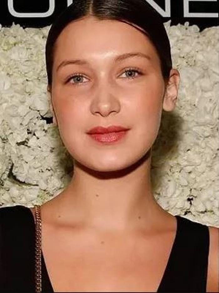 Bella Hadid'in Estetik Operasyon Geçmişi Ve Görüşleri