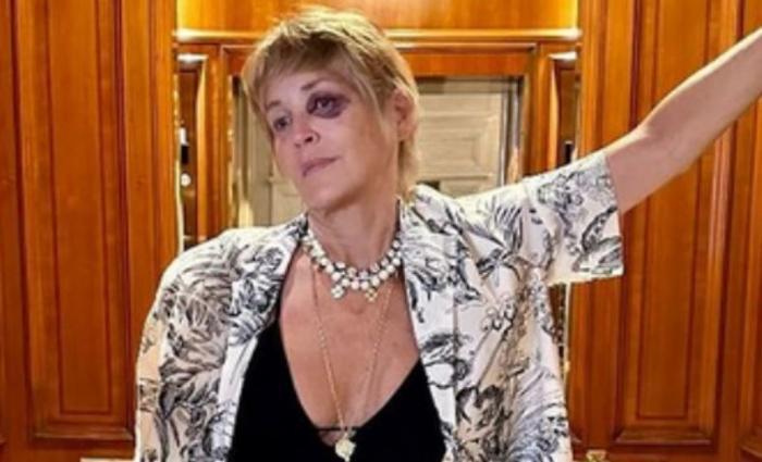 Sharon Stone Bodrum'da kaza geçirdi, gözünü mermere çarparak morarttı