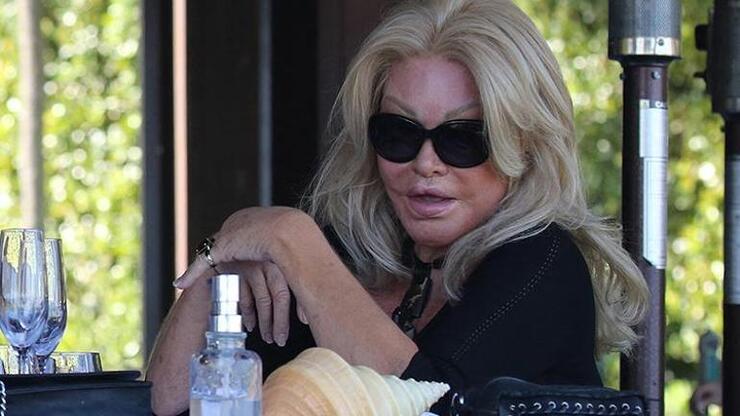 "Kedi Kadın" Jocelyn Wildenstein'in Estetik Ameliyatları Şaşkınlık Yarattı, Gençlik Hali Göz Dolduruyor