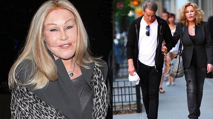 "Kedi Kadın" Jocelyn Wildenstein'in Estetik Ameliyatları Şaşkınlık Yarattı, Gençlik Hali Göz Dolduruyor