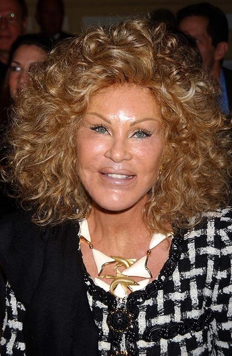 "Kedi Kadın" Jocelyn Wildenstein'in Estetik Ameliyatları Şaşkınlık Yarattı, Gençlik Hali Göz Dolduruyor