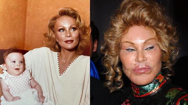 "Kedi Kadın" Jocelyn Wildenstein'in Estetik Ameliyatları Şaşkınlık Yarattı, Gençlik Hali Göz Dolduruyor