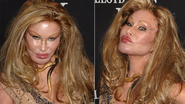 "Kedi Kadın" Jocelyn Wildenstein'in Estetik Ameliyatları Şaşkınlık Yarattı, Gençlik Hali Göz Dolduruyor