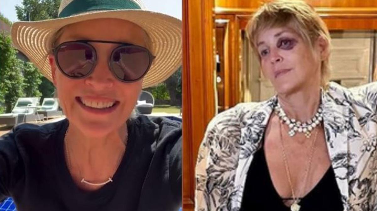 Sharon Stone Bodrum'da kaza geçirdi, gözünü mermere çarparak morarttı