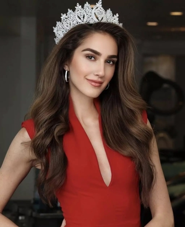 İdil Bilgen'in Miss Turkey 2024 sonrası estetik iddiaları ve sosyal medya paylaşımları tartışma yarattı