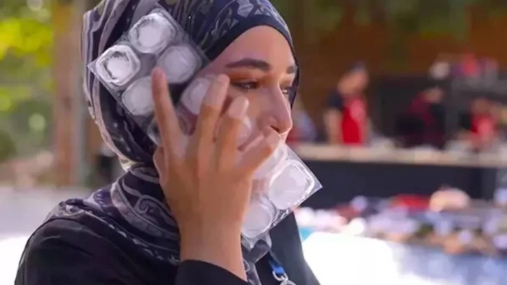 MasterChef'te Beyza'nın Yüzüne Kızgın Yağ Dökülünce Alper Çıldırdı!