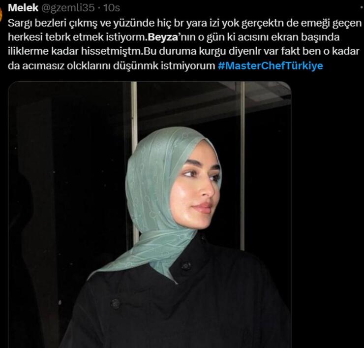 Beyza'nın Yüzündeki Yaraları Aniden Kayboldu, İzleyiciler Kazanın Kurgusal Olabileceğini Tartışıyor