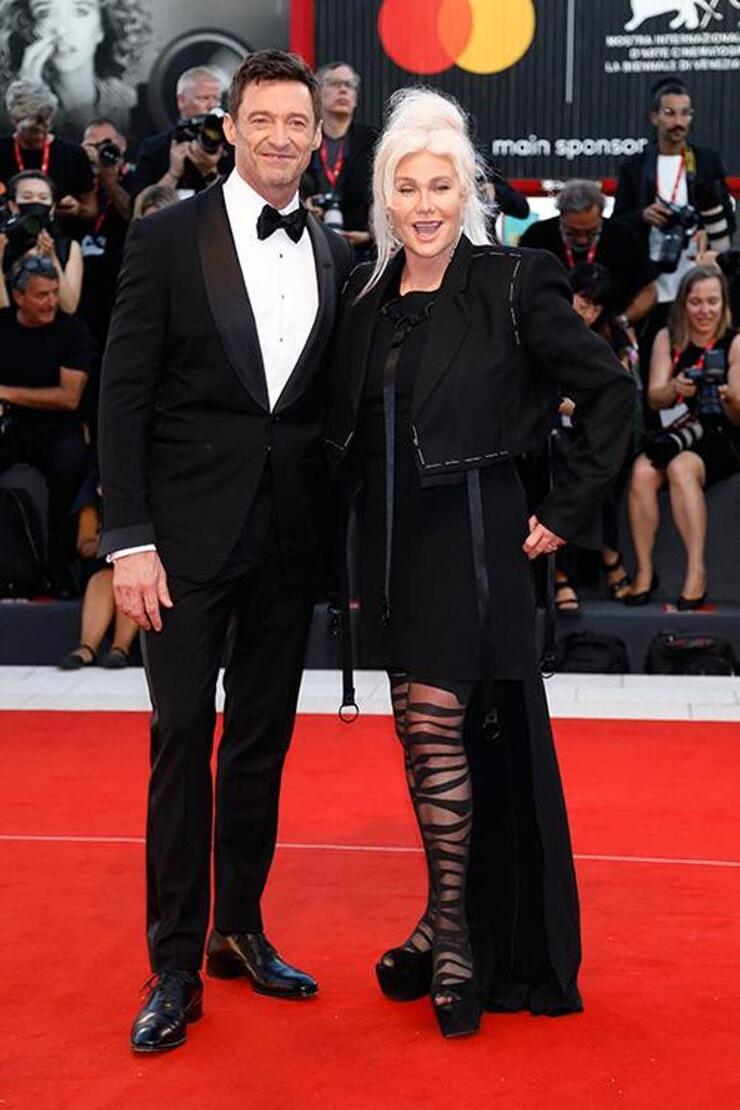 Hugh Jackman ve Deborra Lee Furness Boşanıyor: Aşkından Yerinde Duramıyor!